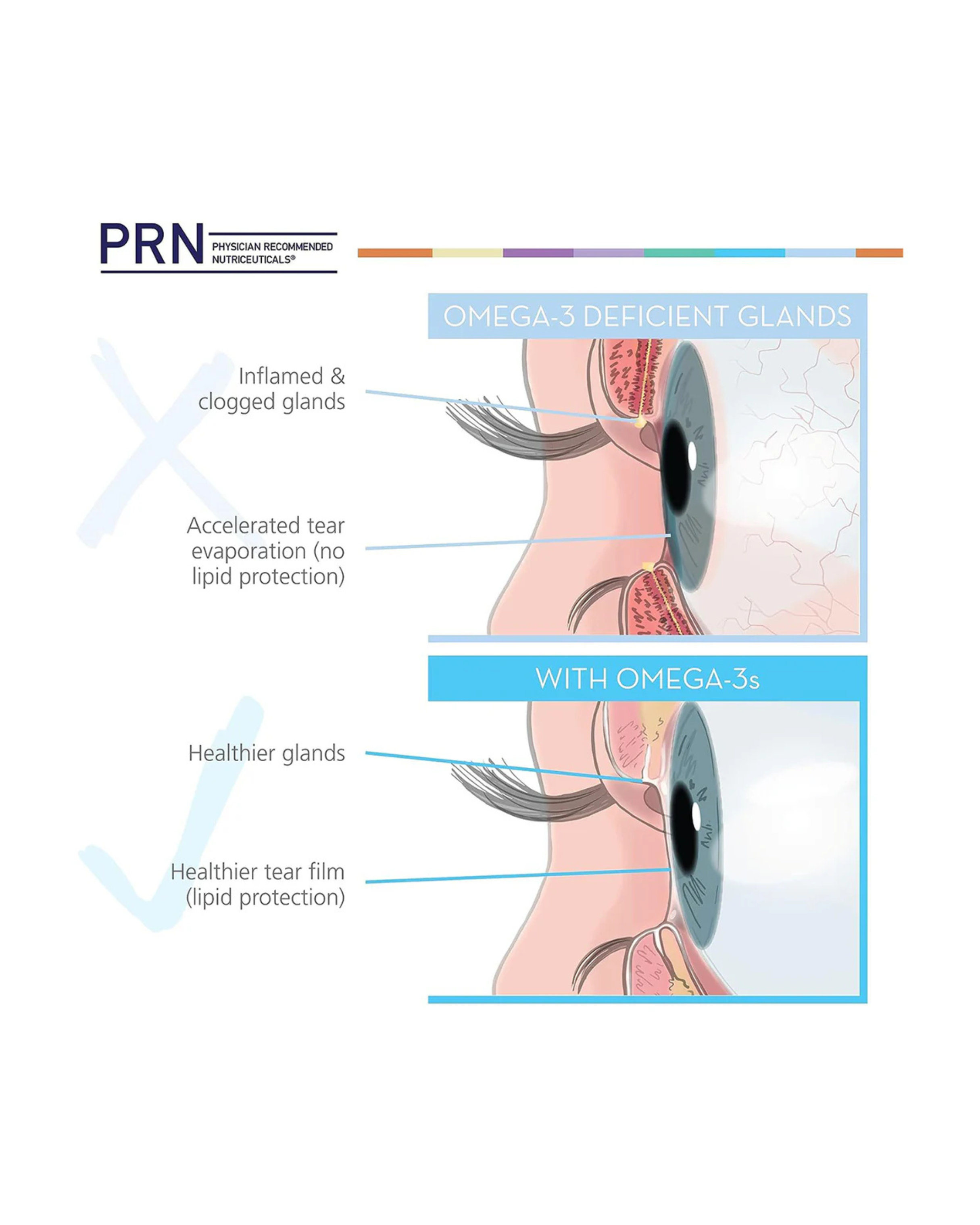 PRN DE3 Dry Eye Omega Benefits® (90/180/270ct. 1-3 Month Supply)